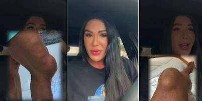 Gracyanne Barbosa mostra joelho inchado durante ensaios da ‘Dança dos Famosos’ Foto: Reprodução/Instagram @graoficial / Estadão